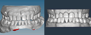 デジタル歯科診断のイメージ