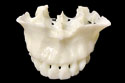 顎骨模型